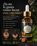 Aceite Batana para la calvicie y crecimiento del cabello 100 Puro con Romero y Maca