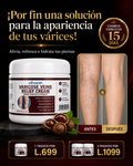 Crema para eliminar varices